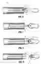 Fig. 04 - Deployable jaws retraction device
