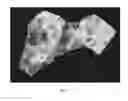 Fig. 09 - System and method for predicting future fractures
