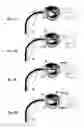 Fig. 08 - ENDOSCOPIC IMAGING PHOTODYNAMIC THERAPY SYSTEM AND METHODS OF USE