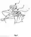 Fig. 02 - NEUROLOGICAL STIMULATION AND ANALYSIS