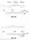 Fig. 35 - Ultrasonic surgical apparatus and methods for use thereof