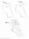 Fig. 02 - Orthopedic auxiliary aid comprising an introduceable functional element