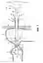 Fig. 02 - Temporary ostomy appliance