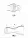 Fig. 04 - Temporary ostomy appliance