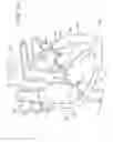 Fig. 02 - METHODS AND IMPLANTABLE DEVICES FOR TREATING SUPRAVENTRICULAR ARRHYTHMIAS