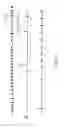 Fig. 07 - METHODS AND IMPLANTABLE DEVICES FOR TREATING SUPRAVENTRICULAR ARRHYTHMIAS