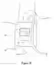 Fig. 20 - Flexible and adjustable wrap for protecting and stabilizing intravenous catheter
