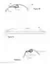 Fig. 22 - Flexible and adjustable wrap for protecting and stabilizing intravenous catheter