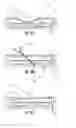 Fig. 05 - DEVICE AND METHODS TO FACILITATE CANNULATION AND PREVENT NEEDLE PUNCTURE BLEEDING OF AN ARTERIOVENOUS FISTULA