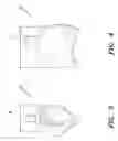 Fig. 03 - Urine Catchment Device