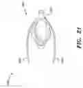 Fig. 16 - Urine Catchment Device
