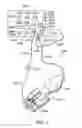Fig. 02 - Systems, apparatus, methods and procedures for the noninvasive treatment of tissue using microwave energy