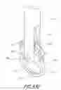 Fig. 41 - Vertebral facet joint drill and method of use