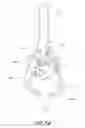 Fig. 43 - Vertebral facet joint drill and method of use