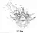 Fig. 77 - Vertebral facet joint drill and method of use