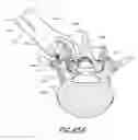 Fig. 79 - Vertebral facet joint drill and method of use