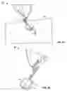 Fig. 07 - Surgical device for conjuctival tissue closure