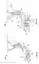 Fig. 08 - Surgical device for conjuctival tissue closure