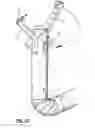 Fig. 33 - Endoscopic Stitching Devices