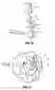 Fig. 35 - Endoscopic Stitching Devices
