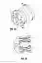 Fig. 40 - Endoscopic Stitching Devices