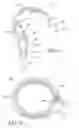 Fig. 06 - IMPLANTABLE RESTRICTION DEVICE WITH SPACER