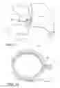 Fig. 08 - IMPLANTABLE RESTRICTION DEVICE WITH SPACER