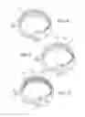 Fig. 05 - IMPLANTABLE RESTRICTION DEVICE WITH PROTECTIVE MEMBER