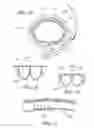 Fig. 10 - IMPLANTABLE RESTRICTION DEVICE WITH PROTECTIVE MEMBER
