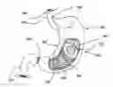 Fig. 01 - Bioerodible self-deployable intragastric implants