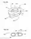 Fig. 10 - Bioerodible self-deployable intragastric implants