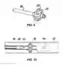 Fig. 05 - Method for treating a target site in a vascular body channel