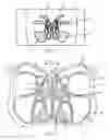 Fig. 02 - Device for remodeling the uncinate process