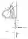 Fig. 05 - Device for remodeling the uncinate process