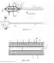 Fig. 10 - Device for remodeling the uncinate process