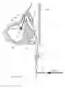 Fig. 17 - Device for remodeling the uncinate process