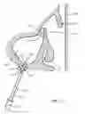 Fig. 30 - Device for remodeling the uncinate process