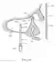 Fig. 32 - Device for remodeling the uncinate process