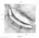 Fig. 41 - Device for remodeling the uncinate process