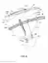 Fig. 07 - Device & method for the positioning of tissue during laparoscopic or endoscopic surgery