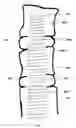 Fig. 01 - Spinal therapy device with fixated distraction distance