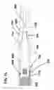 Fig. 13 - Spinal therapy device with fixated distraction distance