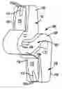 Fig. 01 - Interspinous implant