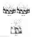 Fig. 04 - SPINOUS PROCESS SPACER AND IMPLANTATION PROCEDURE