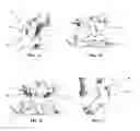 Fig. 09 - SPINOUS PROCESS SPACER AND IMPLANTATION PROCEDURE