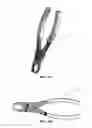 Fig. 22 - SPINOUS PROCESS SPACER AND IMPLANTATION PROCEDURE