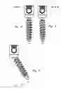 Fig. 02 - Thread-thru polyaxial pedicle screw system