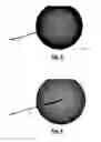 Fig. 03 - SCREW FOR STABILIZING A BONE FRACTURE AND RELATED KIT