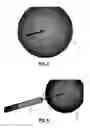 Fig. 04 - SCREW FOR STABILIZING A BONE FRACTURE AND RELATED KIT