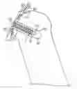 Fig. 01 - Surgical screw and method of performing ligament reconstruction using said screw